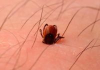 How to get rid of Chiggers and their Bites